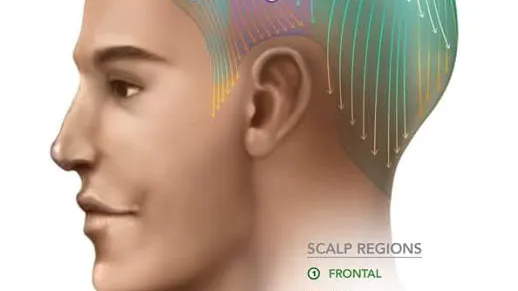PAN Hair Scalp